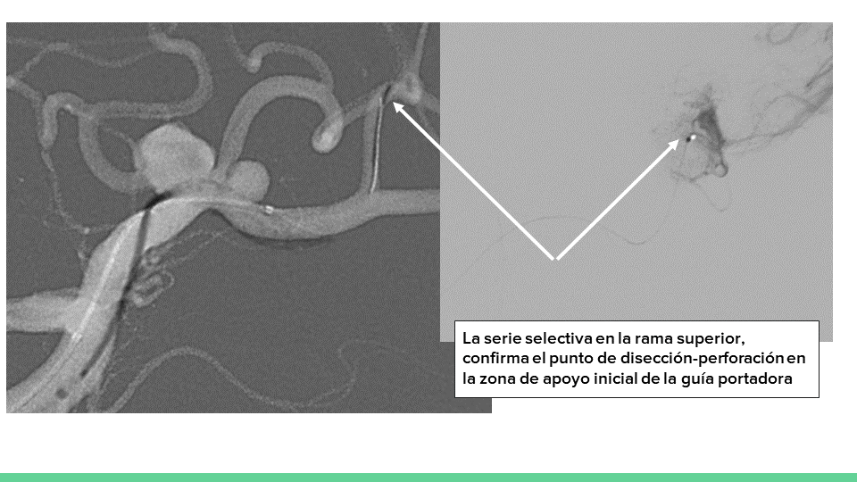neurointervencionismo.es