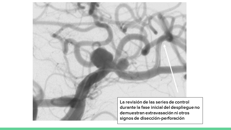 neurointervencionismo.es