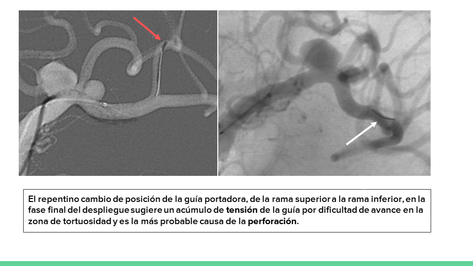 neurointervencionismo.es