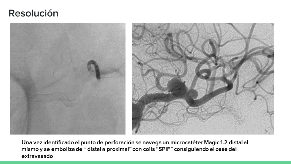 neurointervencionismo.es