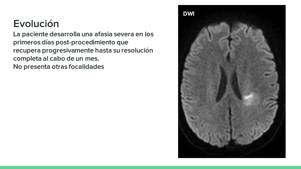 neurointervencionismo.es
