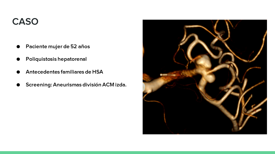 neurointervencionismo.es
