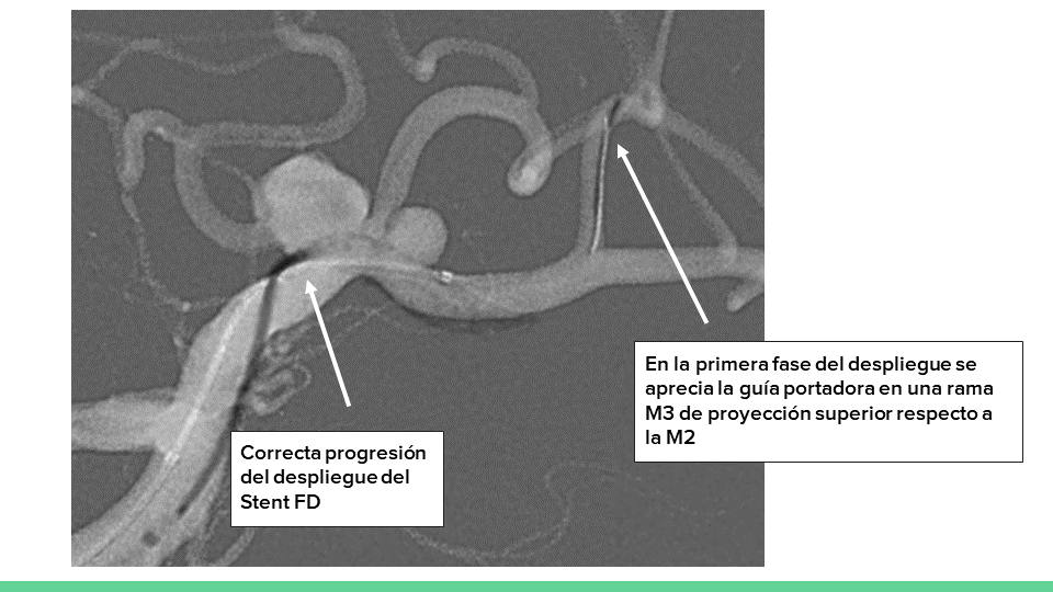 neurointervencionismo.es