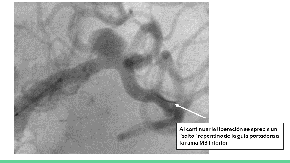 neurointervencionismo.es
