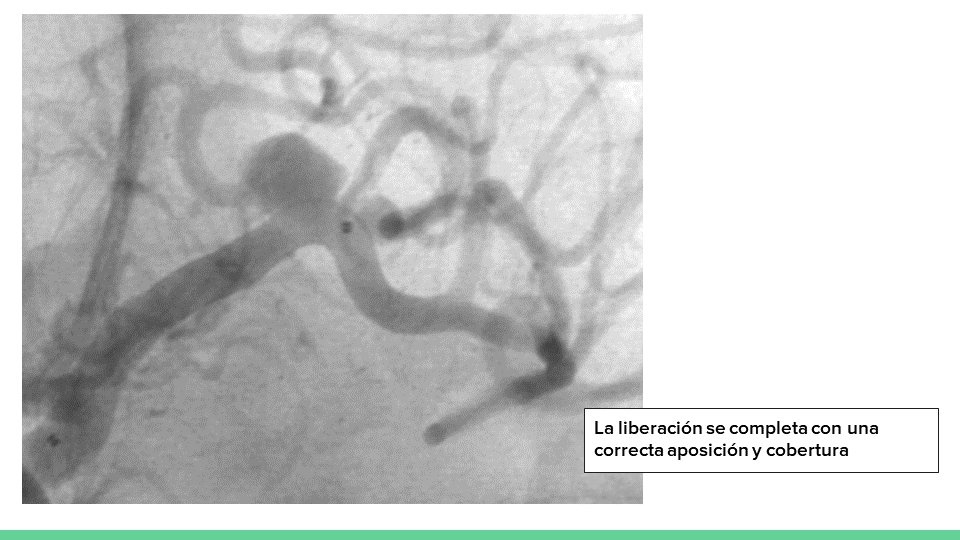 neurointervencionismo.es