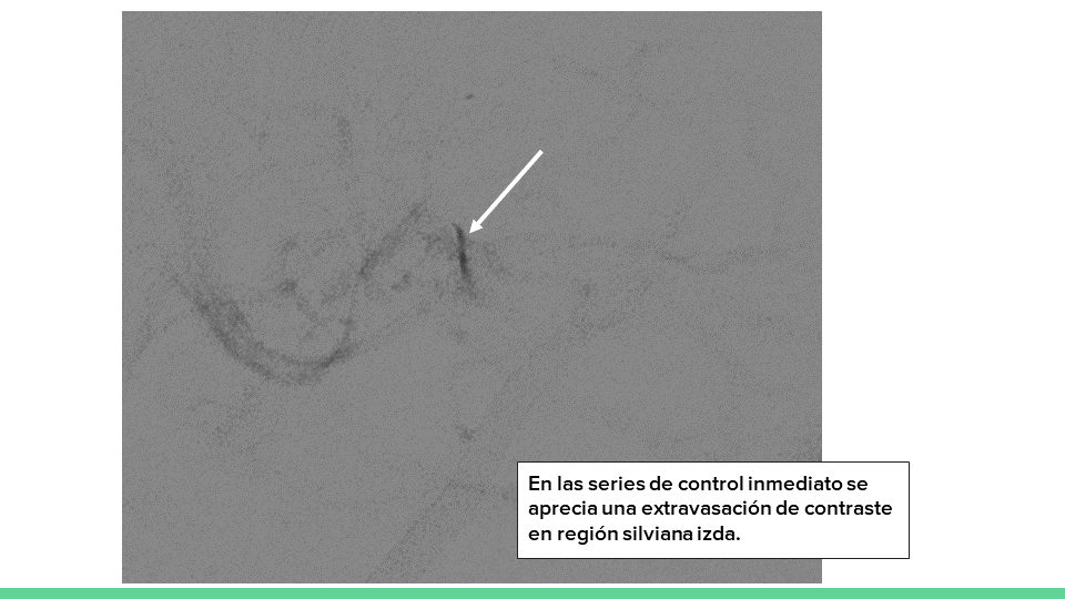 neurointervencionismo.es